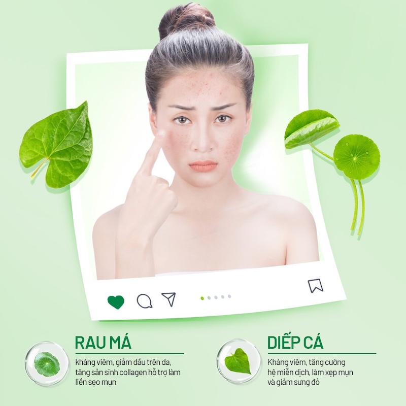 quy trinh 5 buoc cham soc da dau mun toan dien