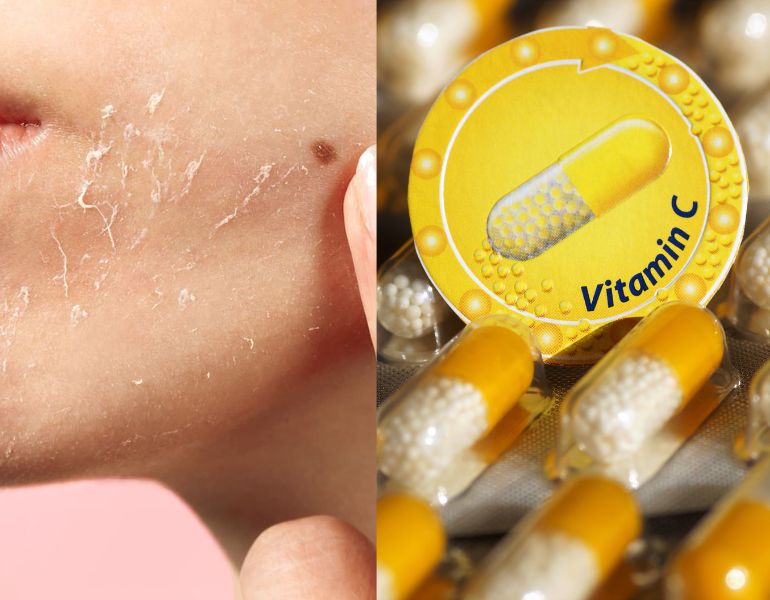 Tẩy da chết và bổ sung vitamin C là các giải pháp phục hồi da thâm sạm hiệu quả