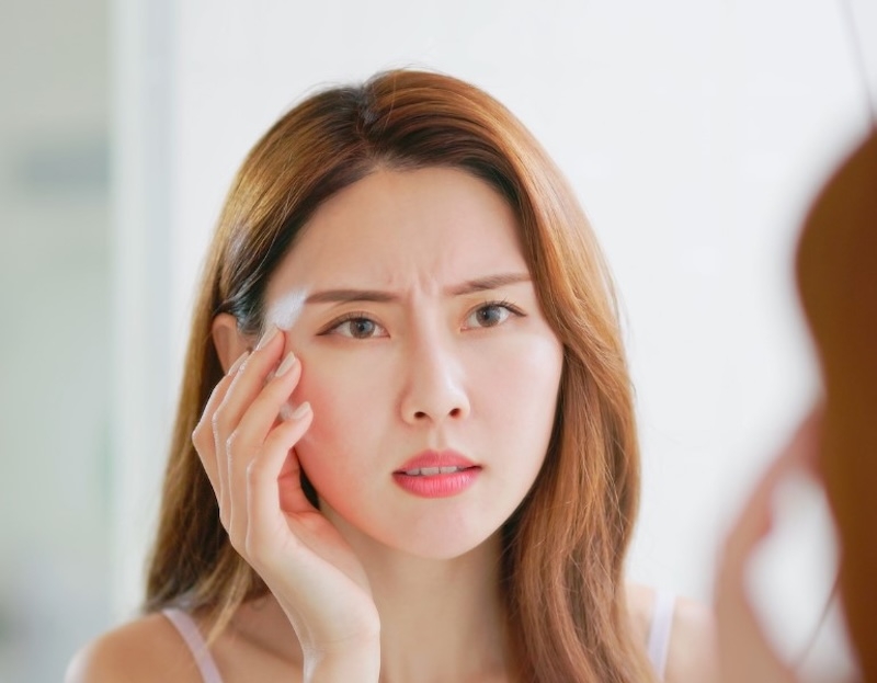 Vì sao da xuất hiện nếp nhăn sớm vi sao da xuat hien nep nhan som