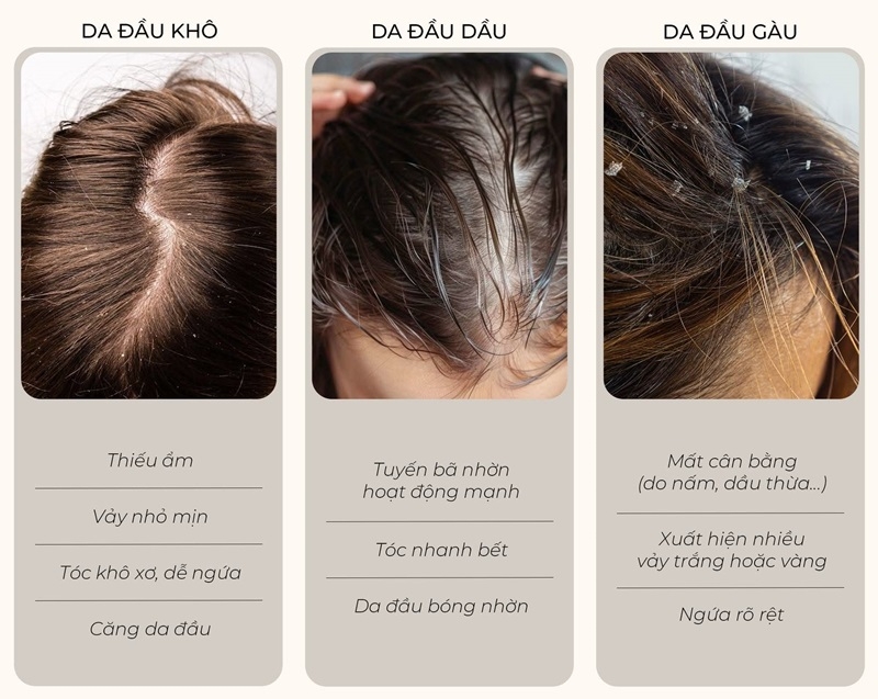 cach cham soc da dau kho nhung toc bet