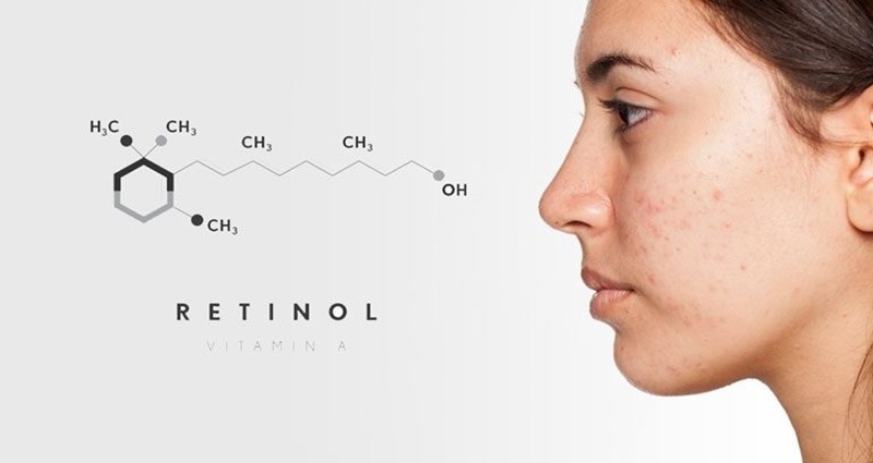 Dung retinoid bi kich ung phai lam sao