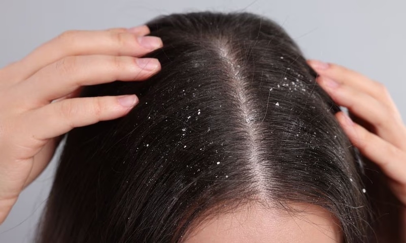 Tại sao gội đầu xong vẫn ngứa tai sao goi dau xong van ngua