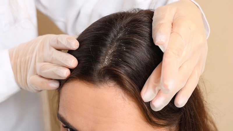 Tại sao gội đầu xong vẫn ngứa tai sao goi dau xong van ngua