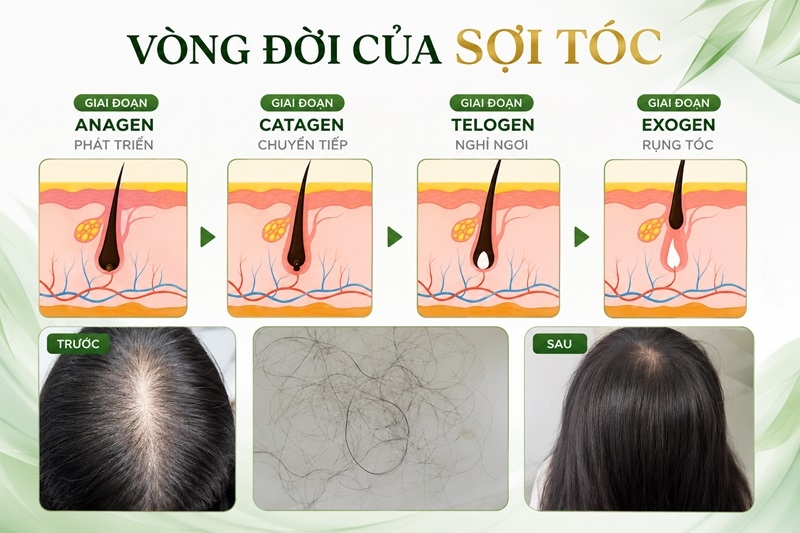 toc rung theo mua co dang lo khong