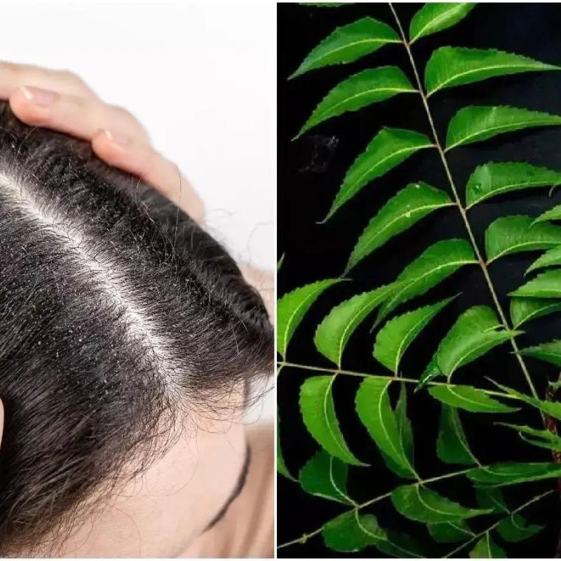 La Neem Azadirachta indica
