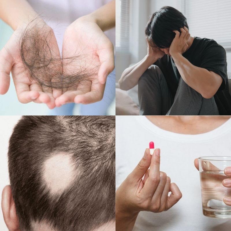 nguyên nhân tóc yếu gãy rụng nguyen nhan toc yeu gay rung