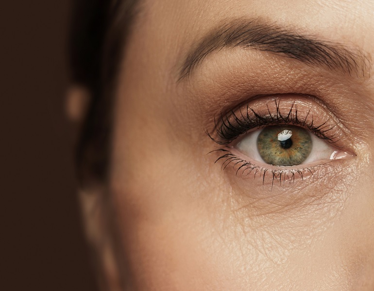Các nếp nhăn hình thành nơi khóe mắt chính là dấu hiệu cho thấy da bạn đang lão hóa