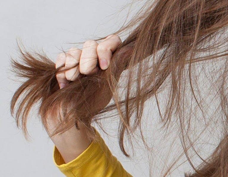 Cách mọc tóc nhanh cho nam tại nhà không khó - META.vn