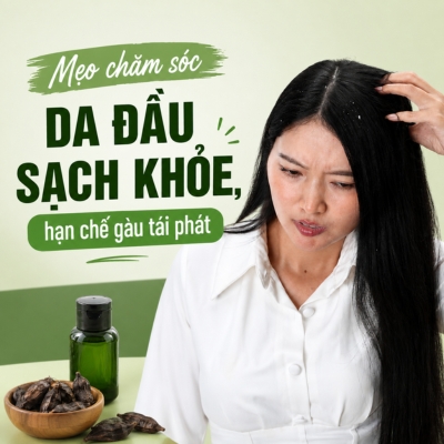 Cách giảm gàu tại nhà: Mẹo chăm sóc da đầu sạch khỏe, hạn chế gàu tái phát