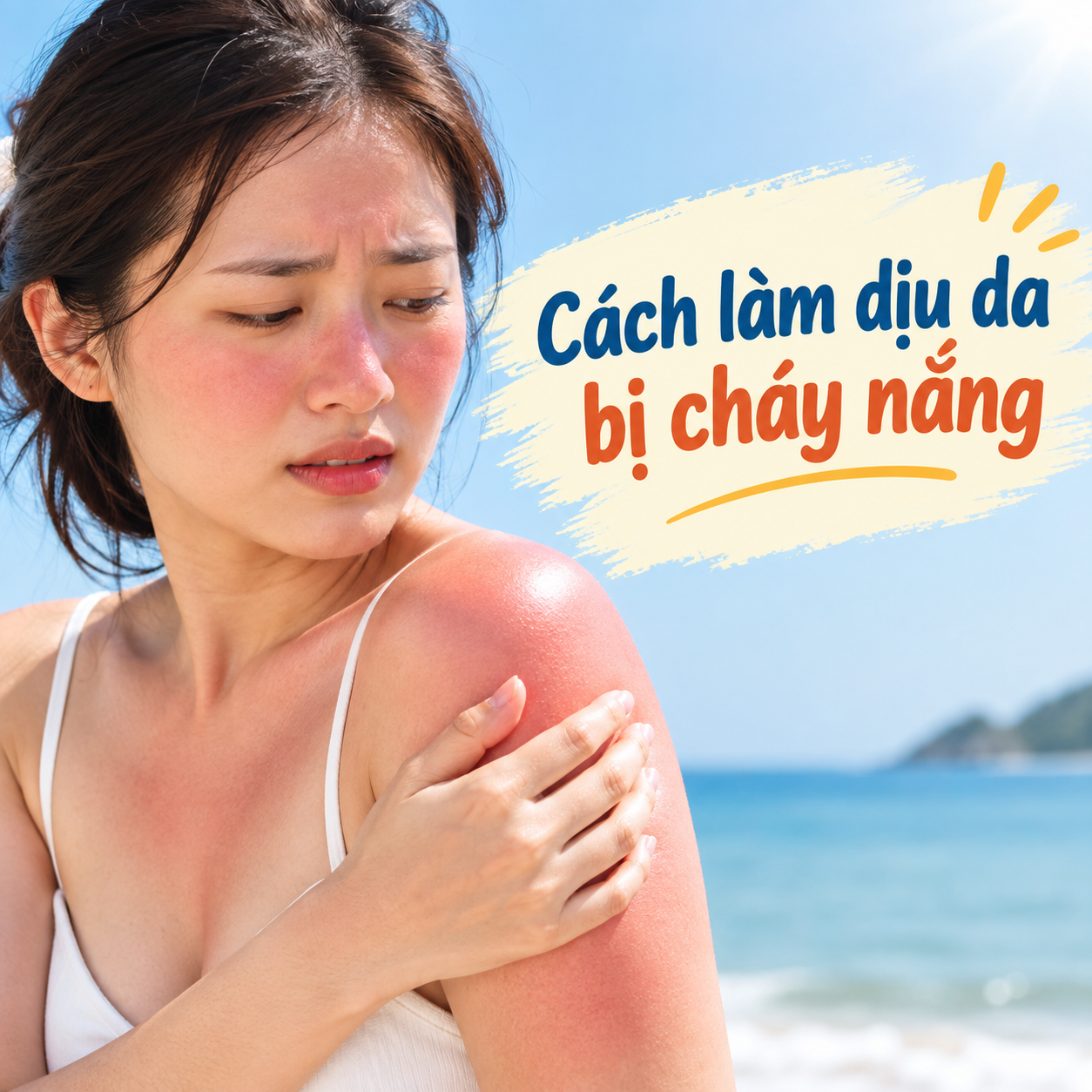 Cách làm dịu da bị cháy nắng đơn giản, an toàn tại nhà