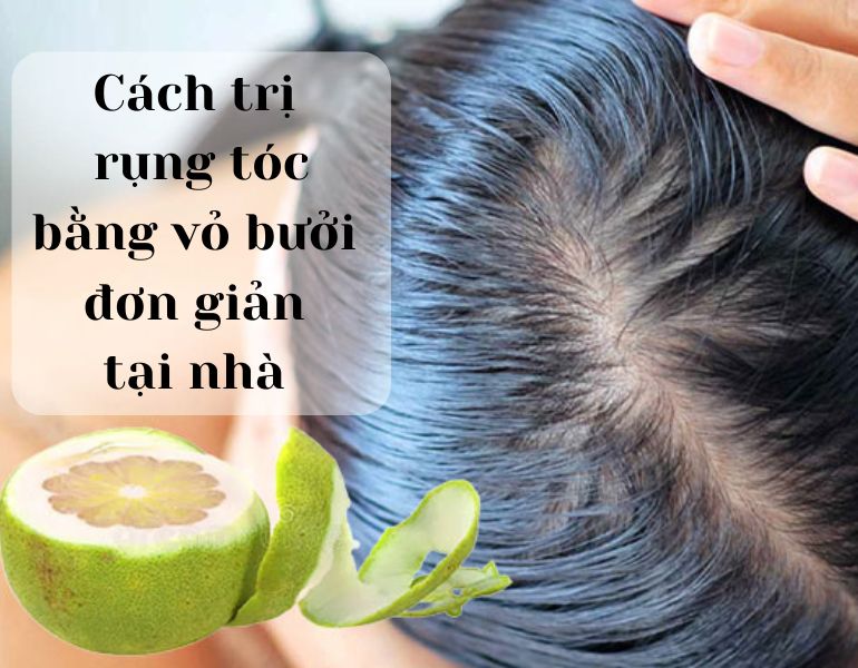 Cách trị rụng tóc bằng vỏ bưởi đơn giản tại nhà