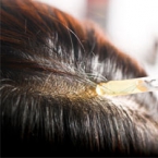 Serum vỏ bưởi và bồ kết herbario ở Bắc Ninh giúp mọc tóc