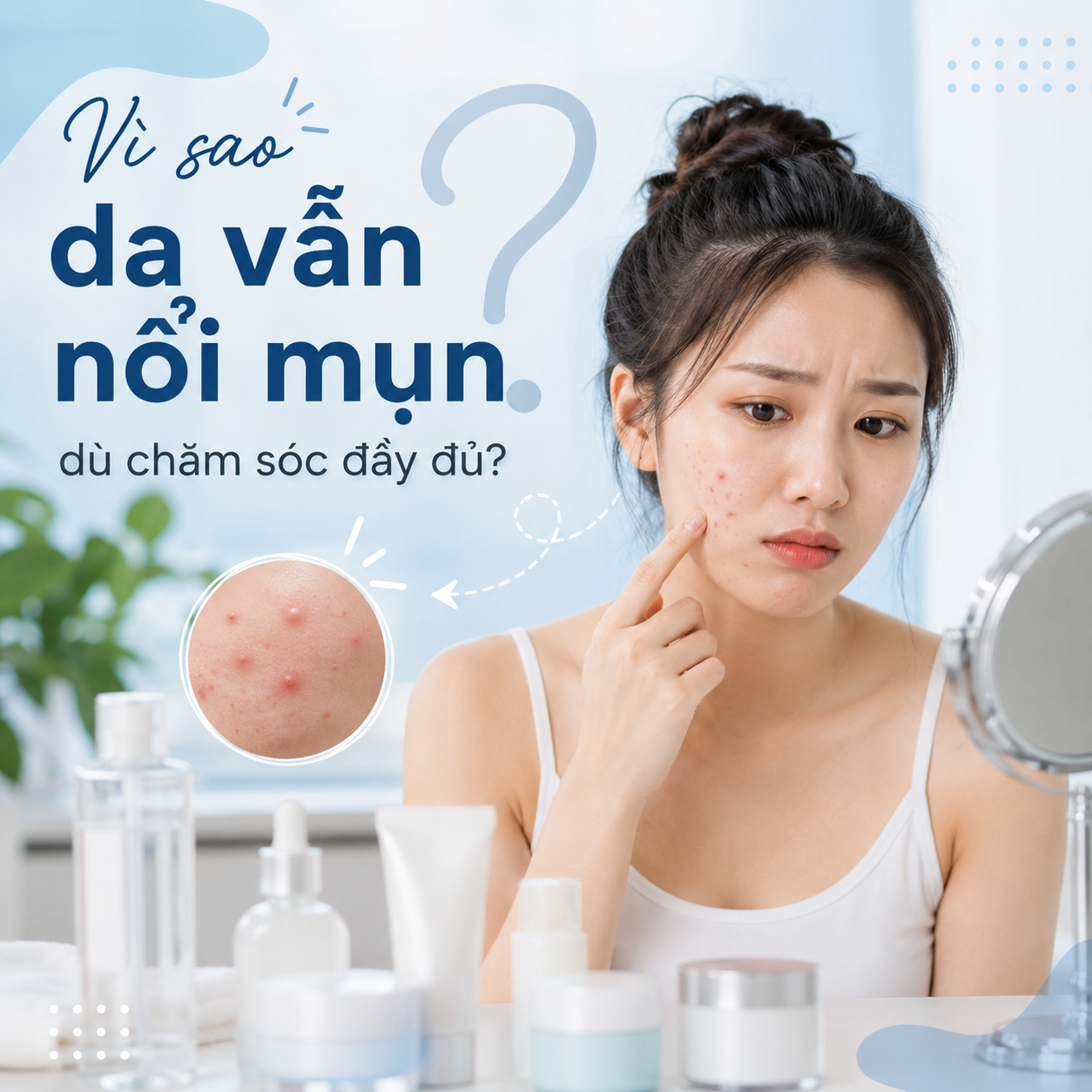 Vì sao da vẫn nổi mụn dù chăm sóc đầy đủ?